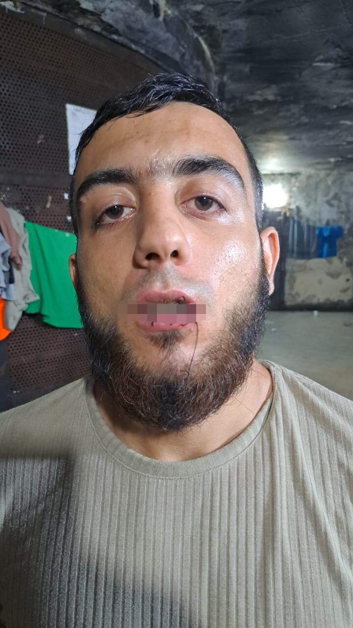 بخياطة أفواههم