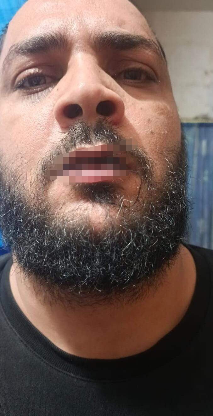 بخياطة أفواههم...إضراب عن الطعام في سجن روميه المركزي