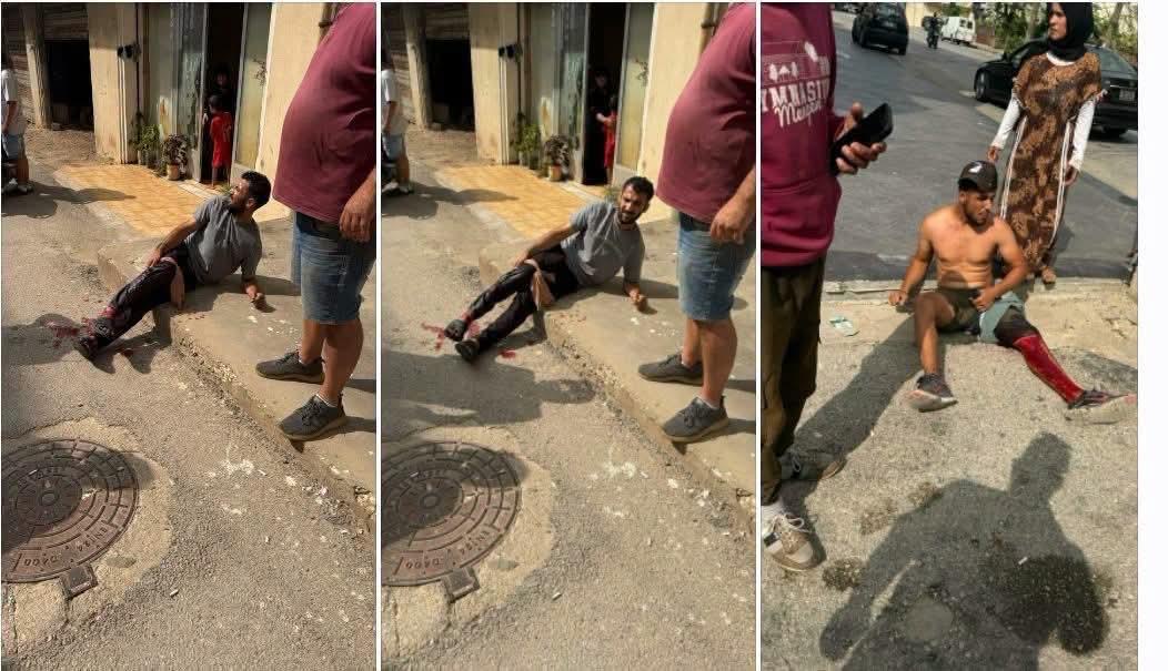 اصابة شخصين في إشكال وإطلاق نار في بلدة أنفه