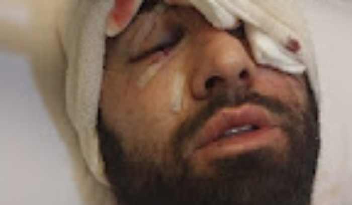 الشيخ زكريا جبارة يتعرّض للضرب في حاريص