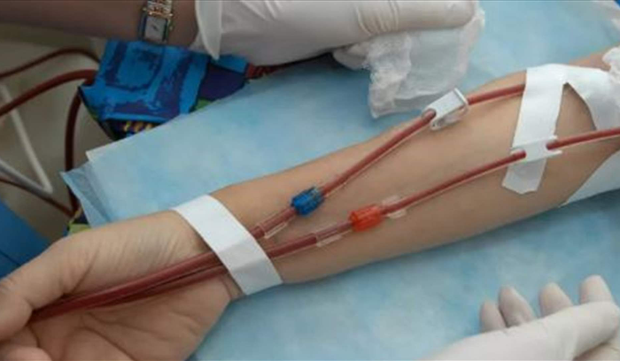 كركي : زيادة تعرفة علاج مرضى غسيل الكلى 60 مرّة كي يبقى مغطًّى 100% من قبل الضمان