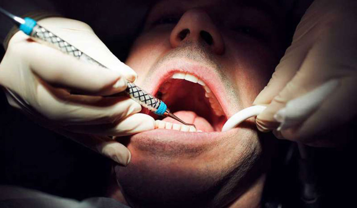 توقيف سوري يمارس مهنة طب الأسنان بلا ترخيص