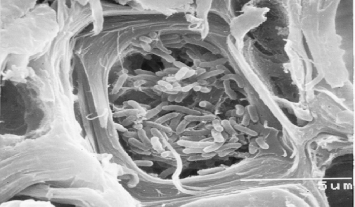 تدابير لمنع انتشار بكتيريا XYLELLA FASTIDIOSA في لبنان