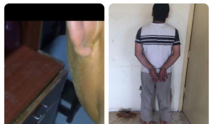 جلد ابنه القاصر بواسطة خرطوم مياه  فأوقفته قوى الامن