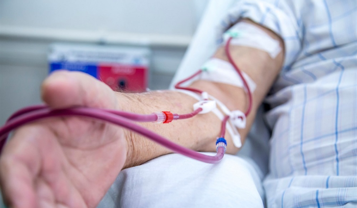 سلفات مالية من “الضمان” لعلاج مرضى غسيل الكلى