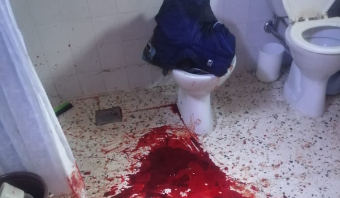 ضربوه على رأسه  في منزله في بجدرفل البترونية وفروا