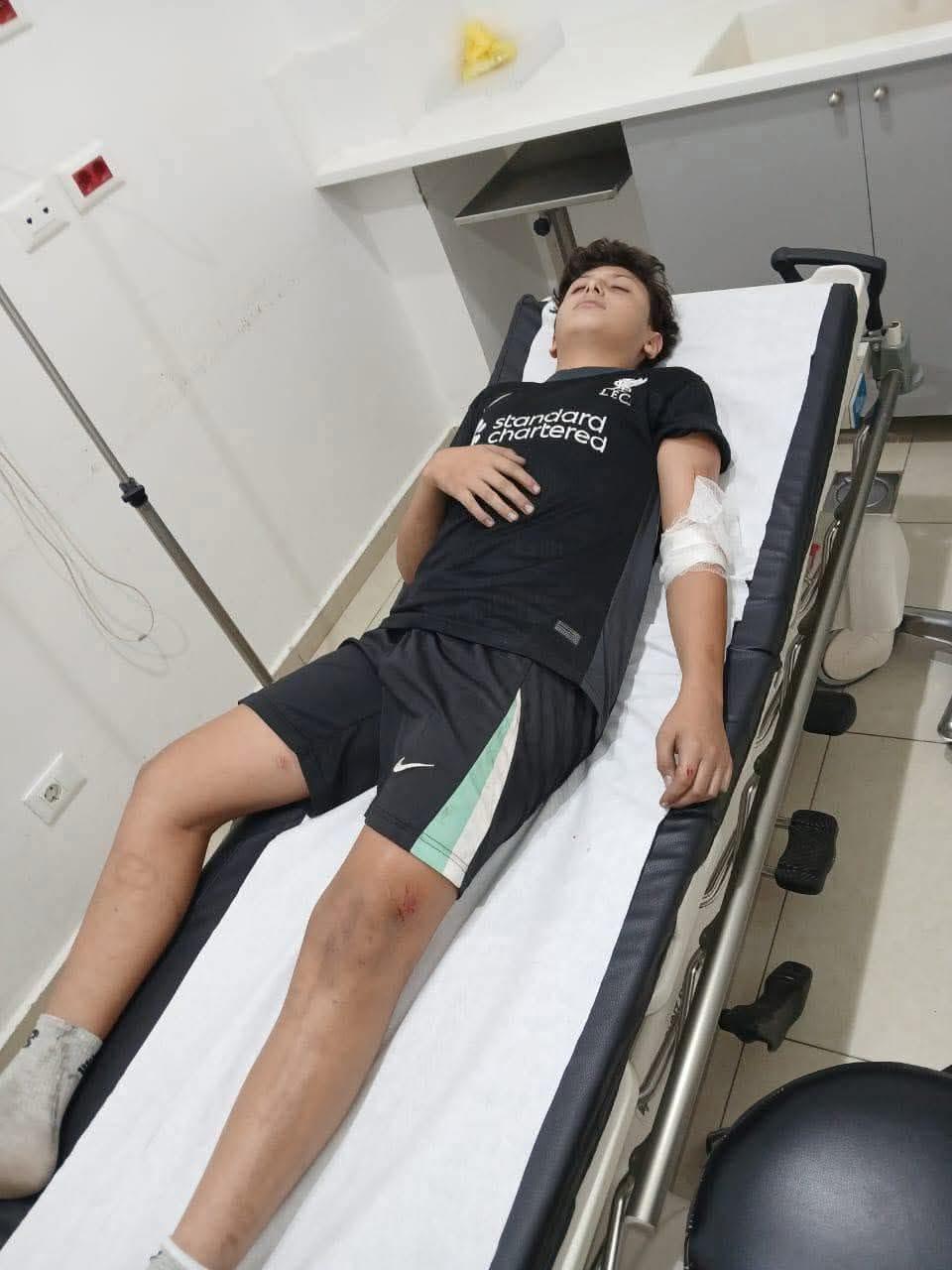 نقل قاصر إلى مستشفى الكورة إثر تعرضه لهجوم كلب شارد في النخلة