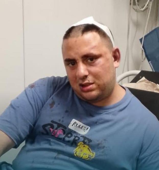 مجهولون اعتدوا على شاب وسلبوه ففقد ذاكرته… هل تعرفونه؟