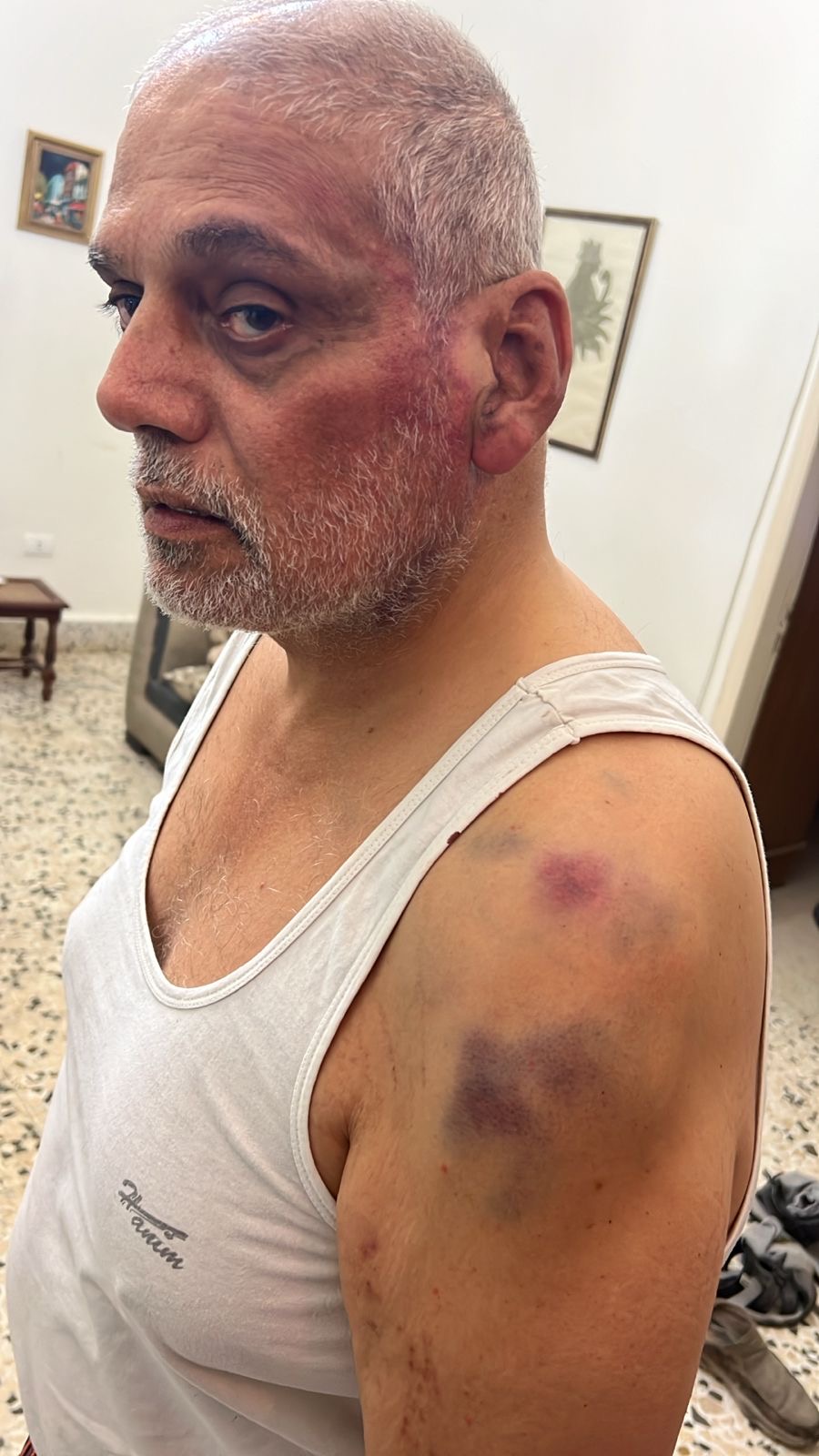 اعتداء على مريض كلي في البترون على يد عناصر من قوى الأمن الداخلي