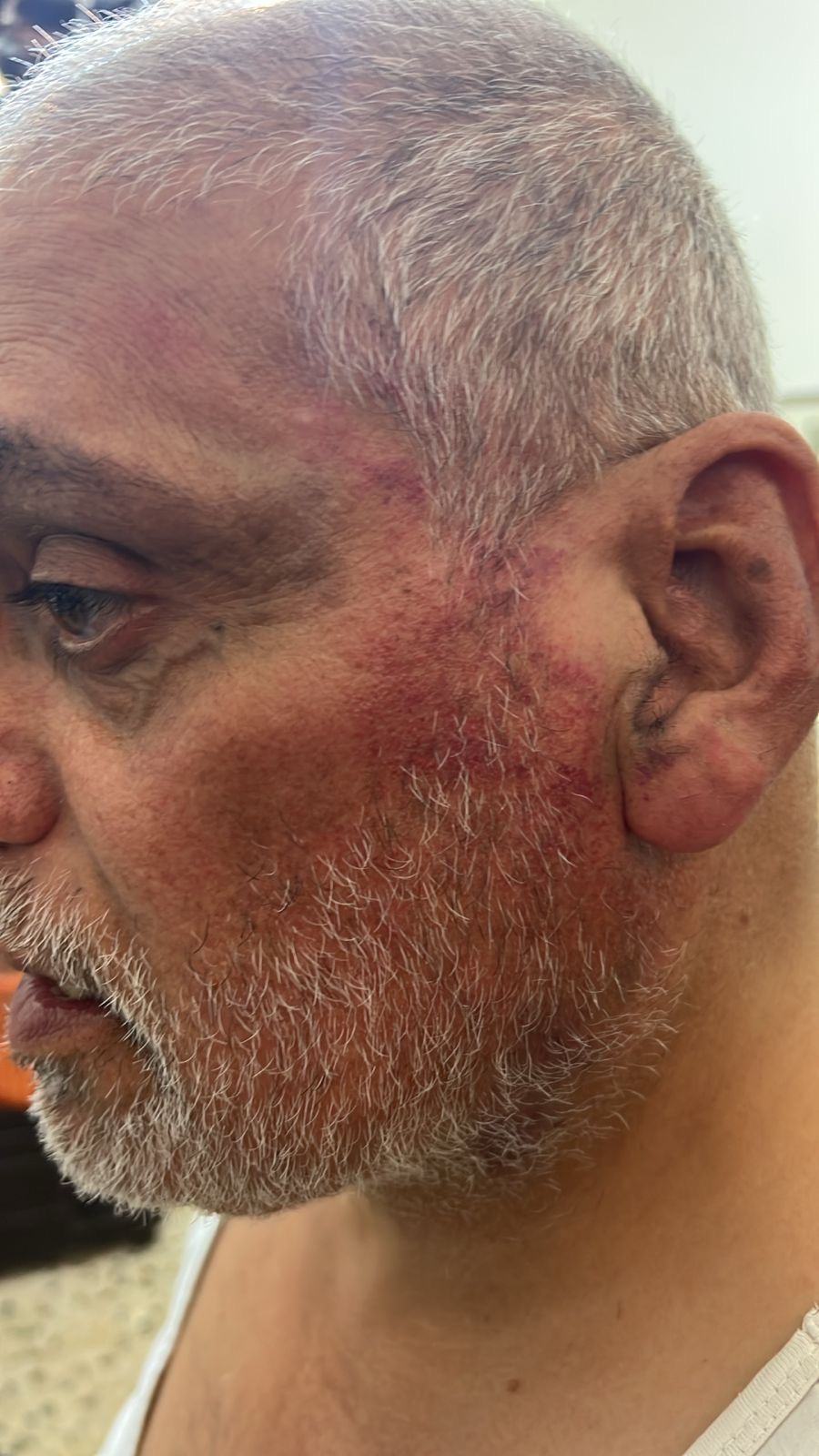 اعتداء على مريض كلي في البترون على يد عناصر من قوى الأمن الداخلي