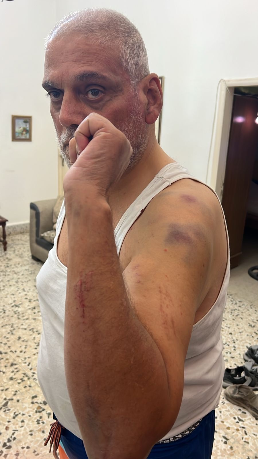 اعتداء على مريض كلي في البترون على يد عناصر من قوى الأمن الداخلي