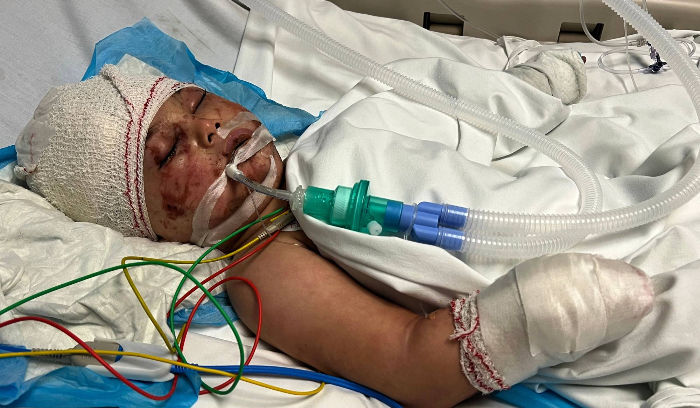 طفل في جنوب لبنان ينجو بعد 14 ساعة تحت الأنقاض<br />
فقدَ والديه وشقيقته وجدتيه... واضطر الأطباء لبتر يده اليمنى من المعصم