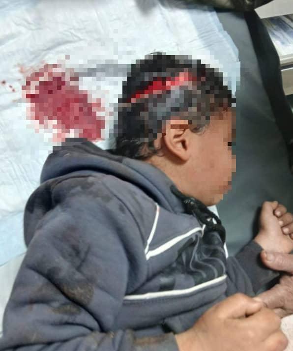 اصابة 4 أشخاص بجروح جراء عضة كلب