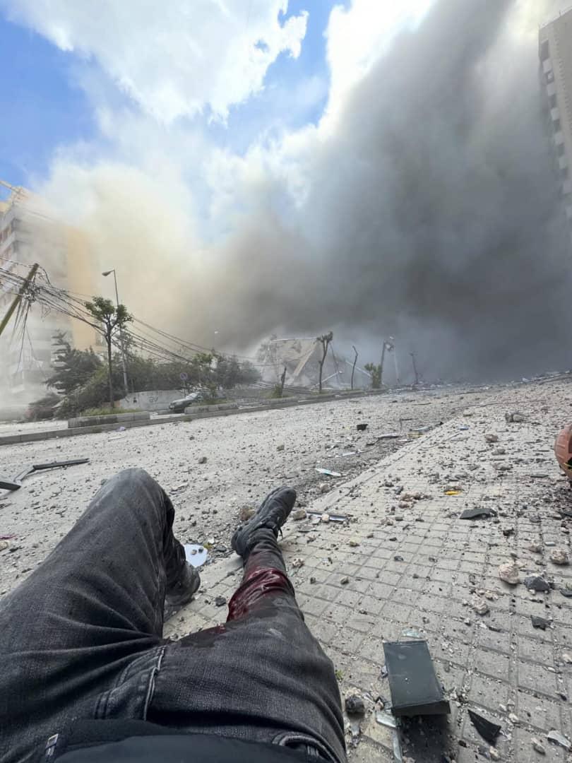 اصابة مدير التصوير في جريدة الأخبار هيثم الموسوي