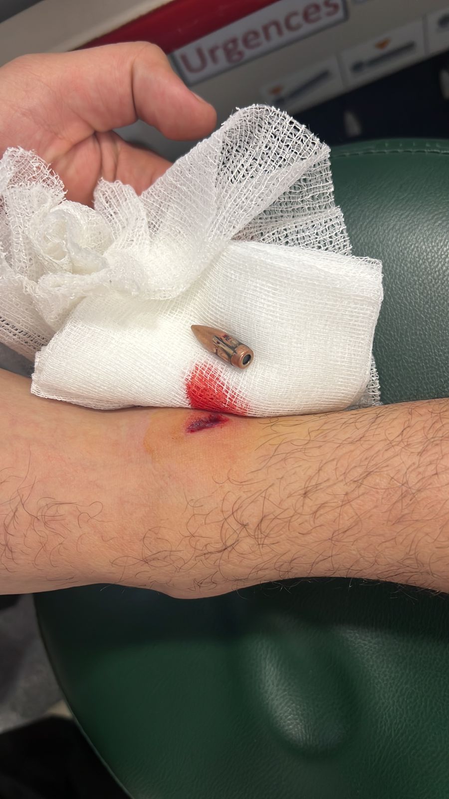 إصابة طالب برصاص طائش في جامعة الحكمة